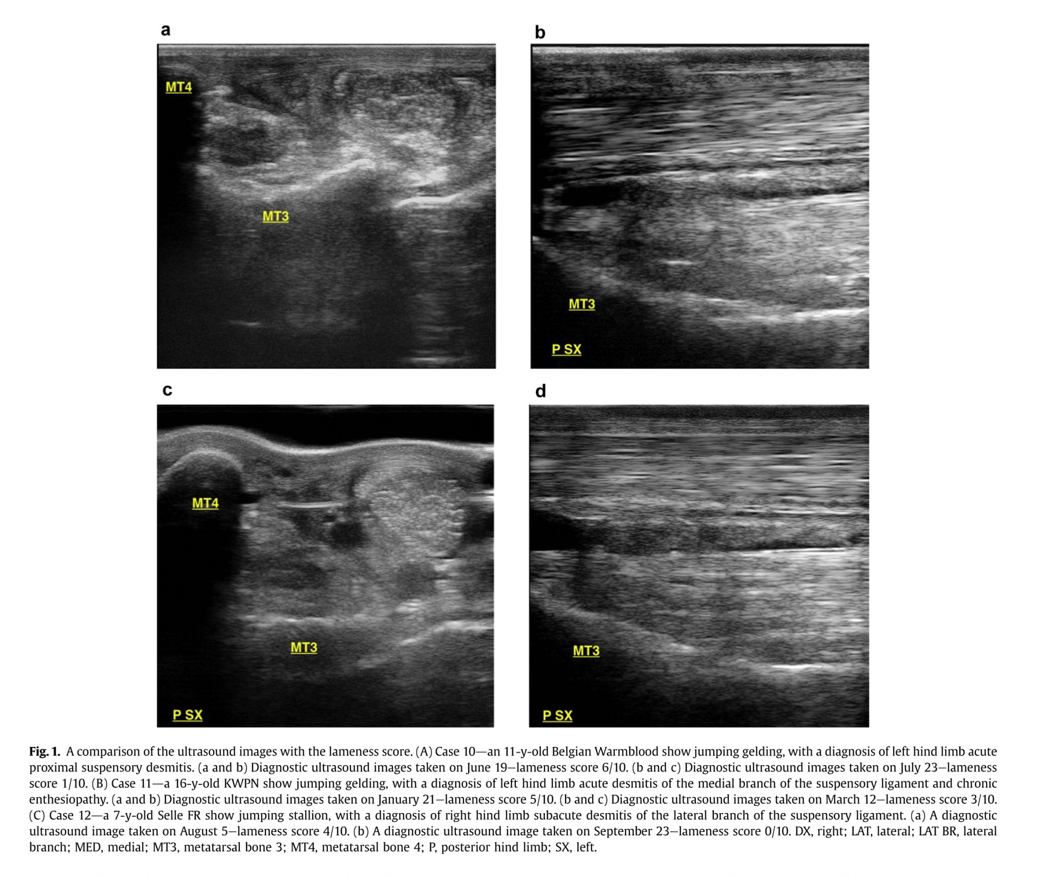 Assessment of Noninvasive Low-Frequency Ultrasound Therapy - Ultrasound Images 1